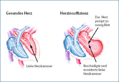 Herz